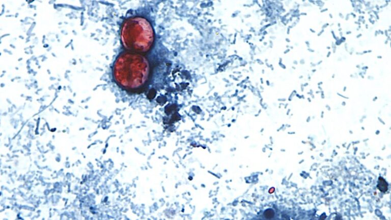 The Scope of the Cyclospora Surge