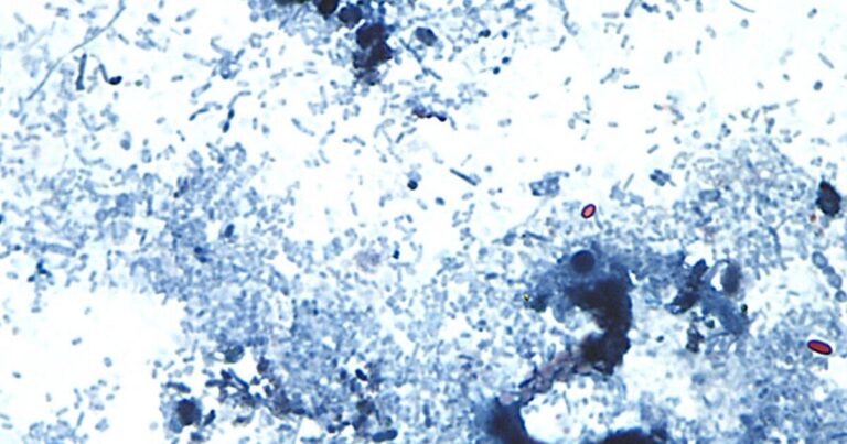 Understanding Cyclosporiasis