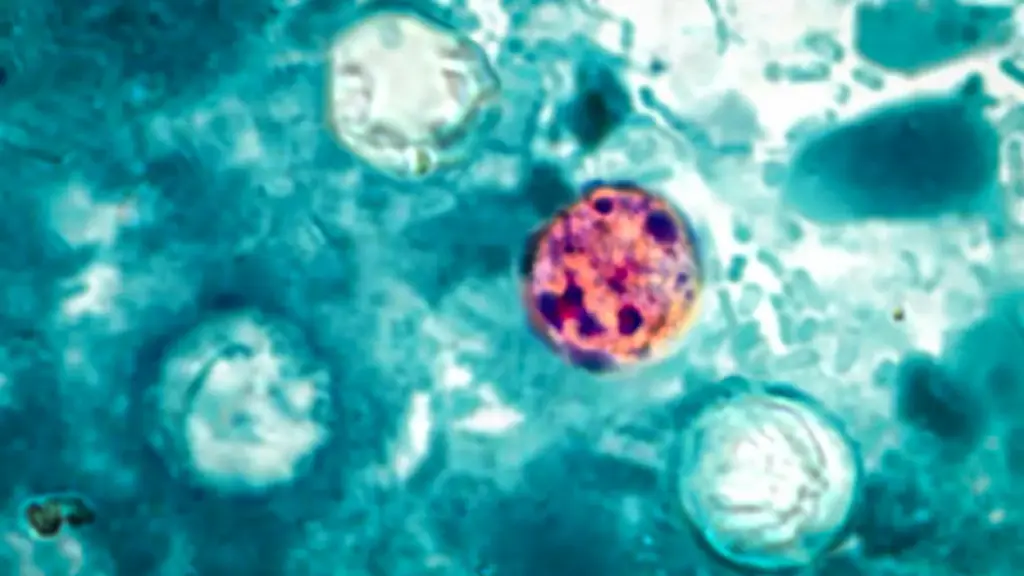 The Growing Scale of the Cyclospora Outbreak