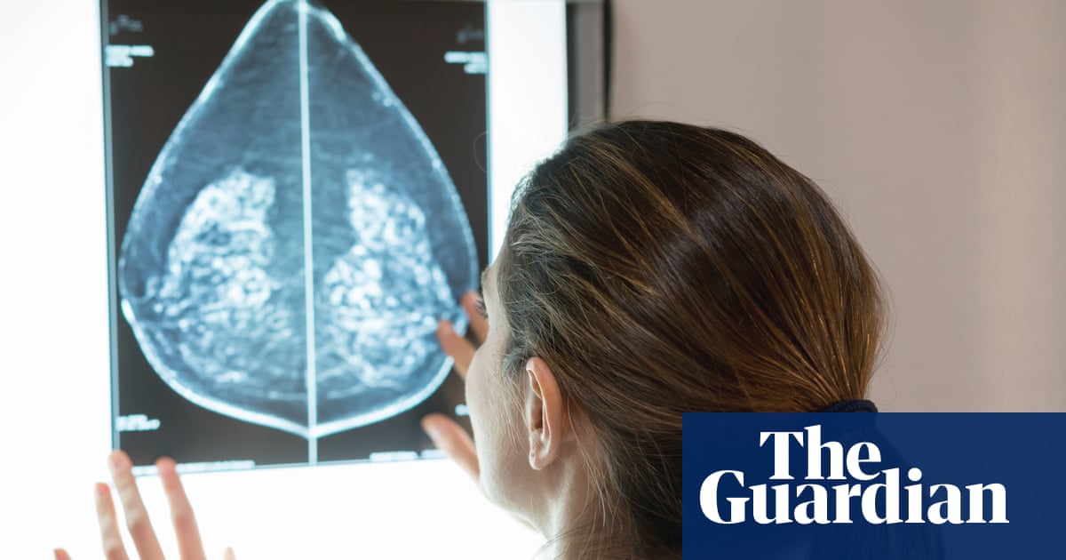 Mammograms could be used to identify heart disease in women