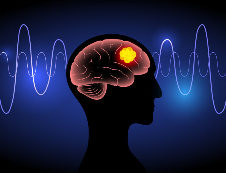 Study points to new target for treating aggressive brain cancer