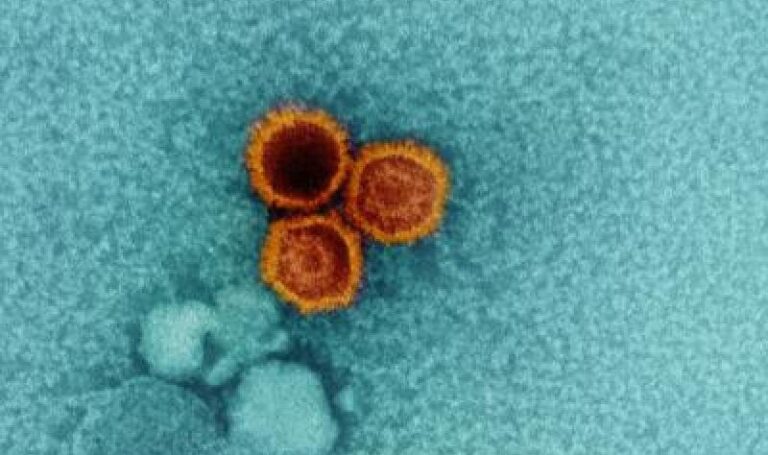 Severe COVID-19 linked to reactivation of some dormant viruses: Study