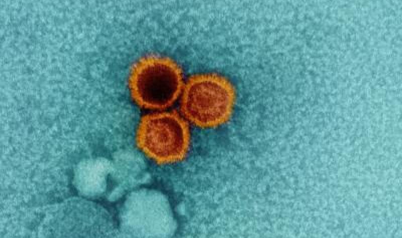 Severe COVID-19 linked to reactivation of some dormant viruses: Study