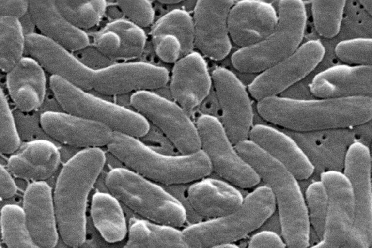 This 2005 electron microscope image provided by the Centers for Disease Control and Prevention shows Vibrio vulnificus