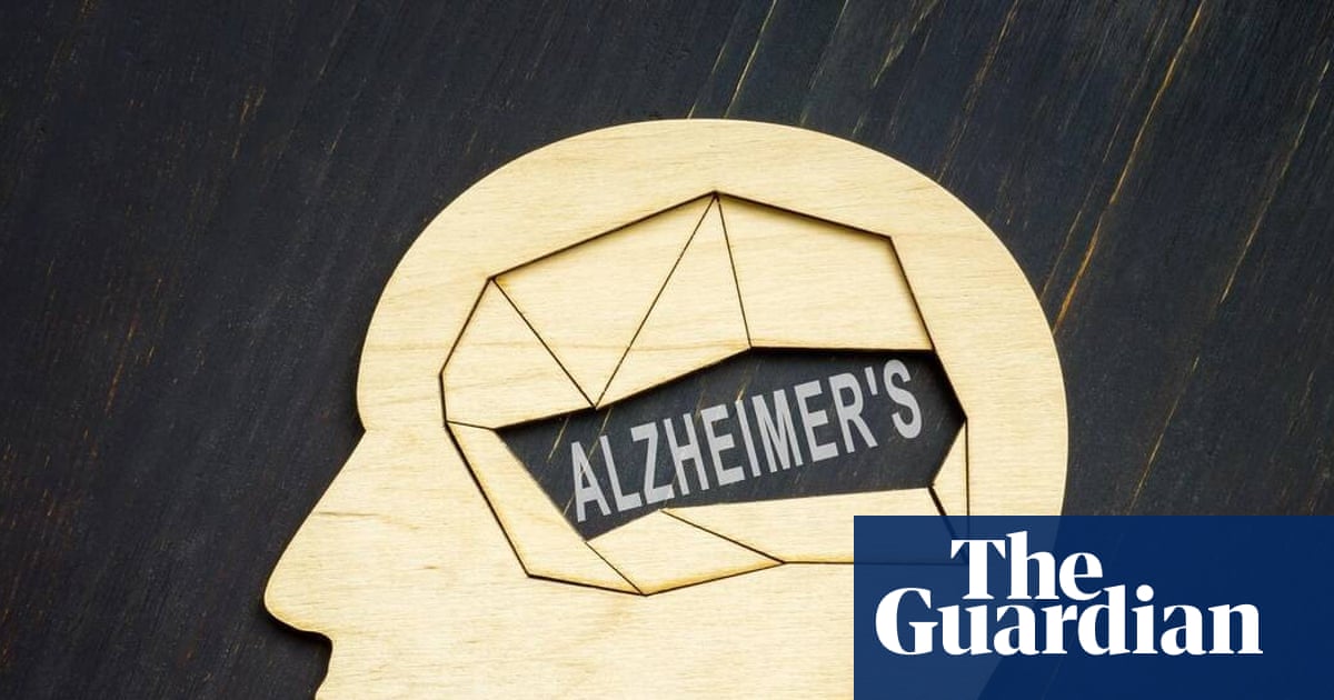 Alzheimer's trial to test drug on people without symptoms to prevent onset
