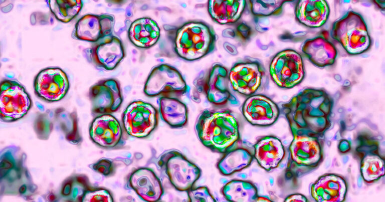 Pennsylvania reports fourth measles-related death, first in state in 35 years