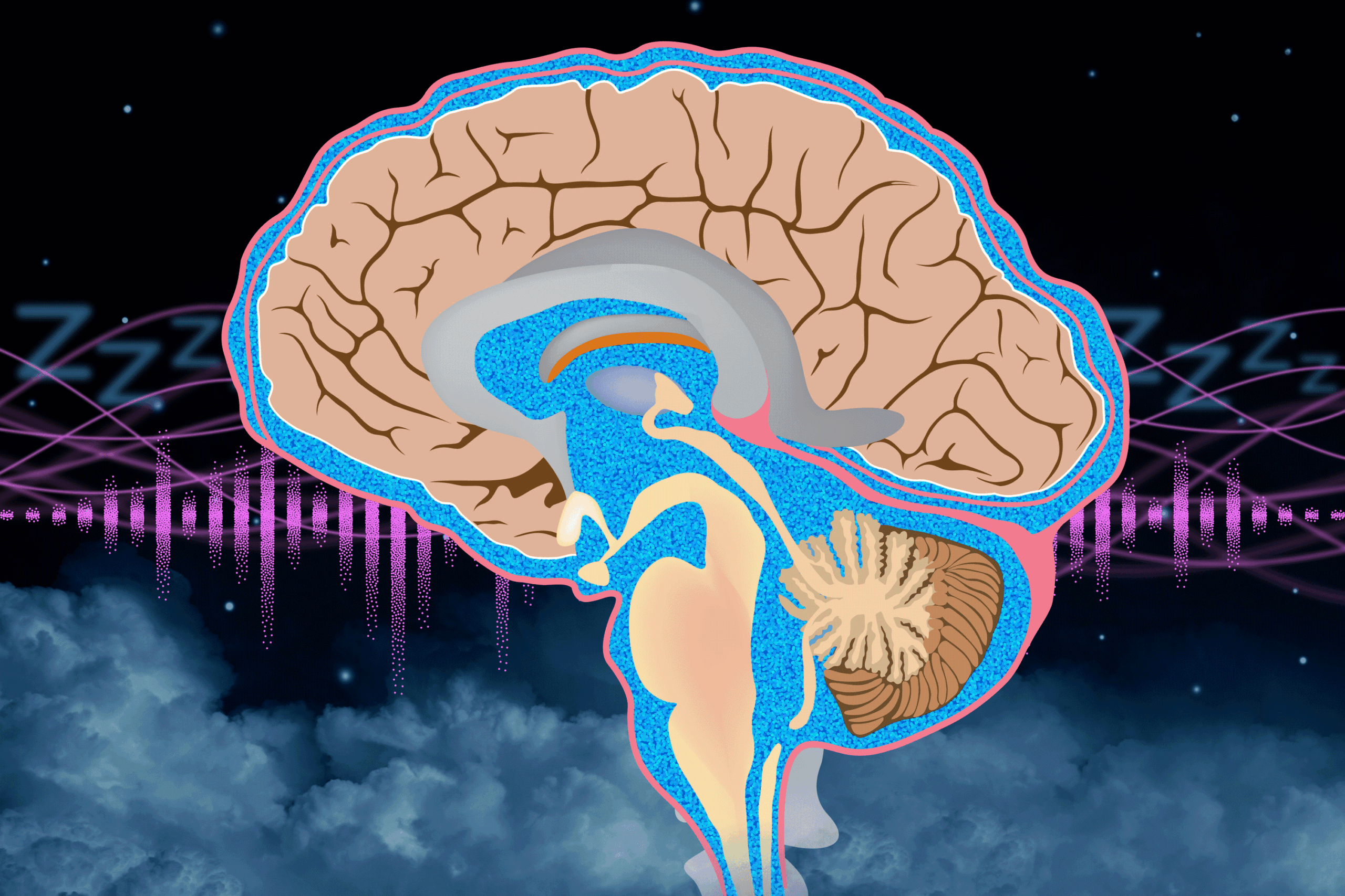 Timed Bursts of Pink Noise Can Boost Brain Waste Clearance During Sleep
