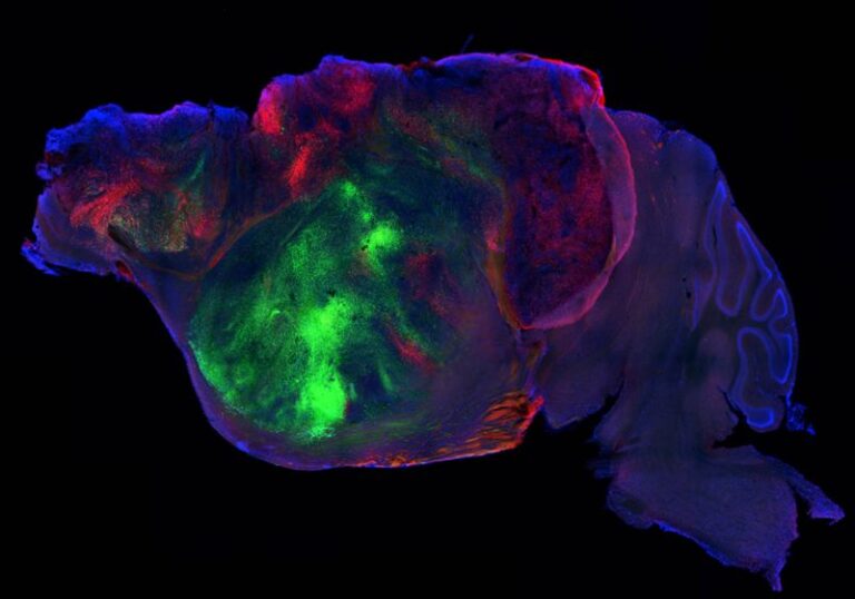 Stanford Transplanted Human Brain Organoids Into Mice