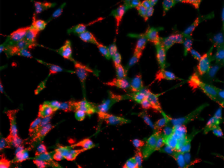 Precision Medicine and Adaptive Therapy in Prostate Cancer Management