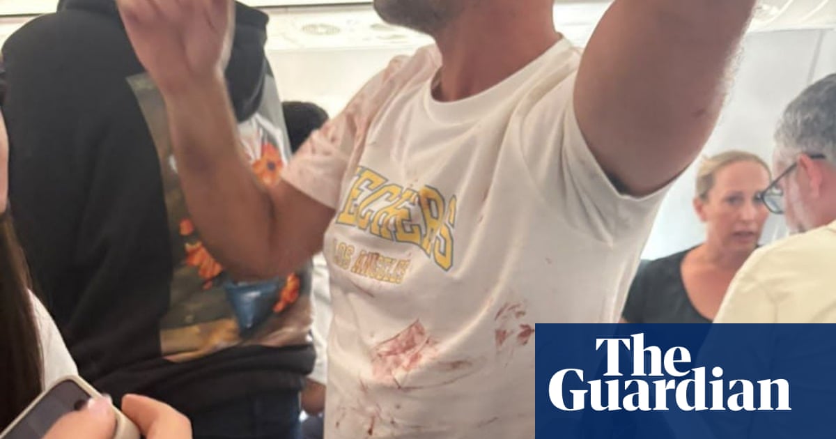 Plane to Israel Narrowly Averts Disaster After Pilot Stabbing