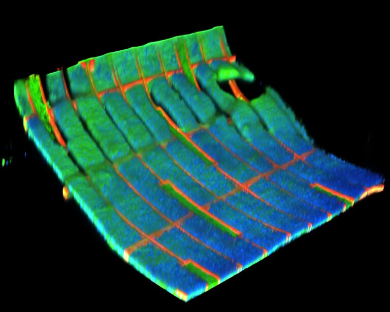 Flexible Mesh Could Power Implantable Electronics Without Batteries