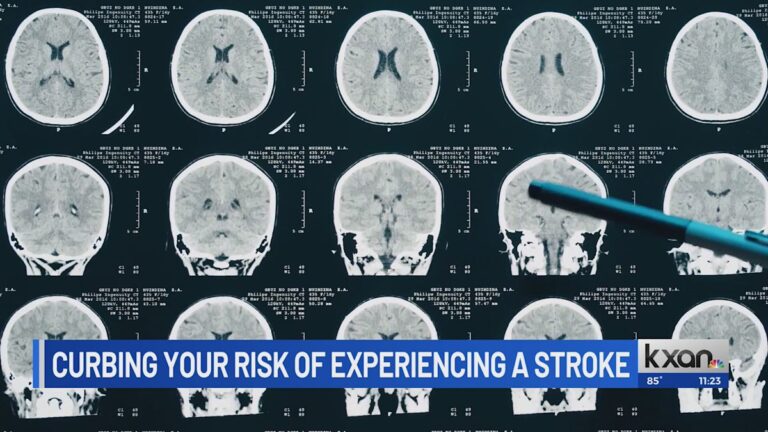 Why are more young adults having strokes now than 30 years ago
